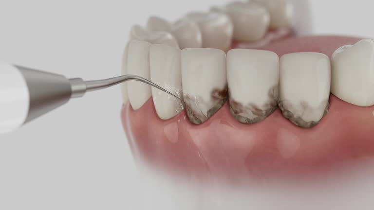 Reliable Dental Implants contractor in Ethete, WY by Smile Center Dentistry